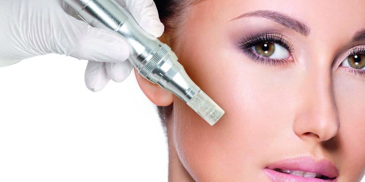 Microneedling